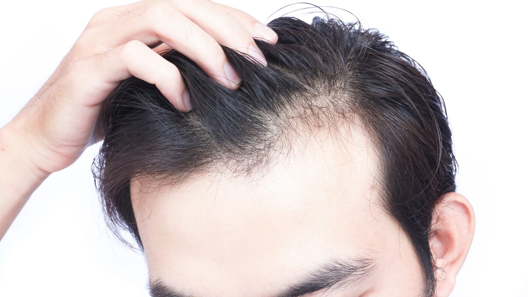 Aşırı saç dökülmesine karşı ne iyi gelir?